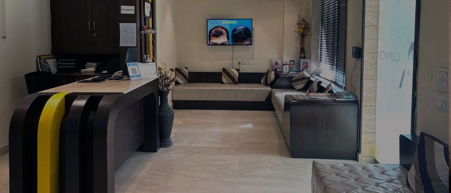 best hair transplant clinic in Delhi
