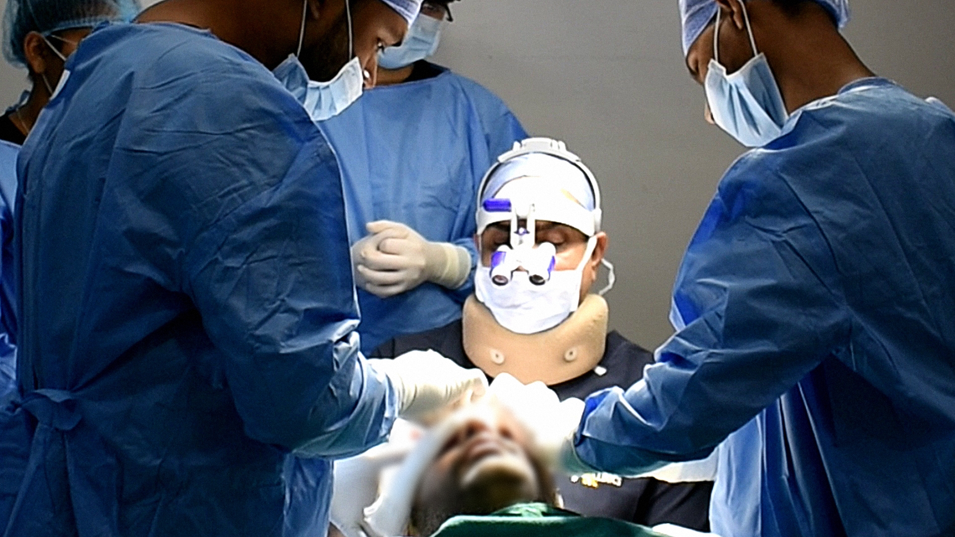 hair transplant cost